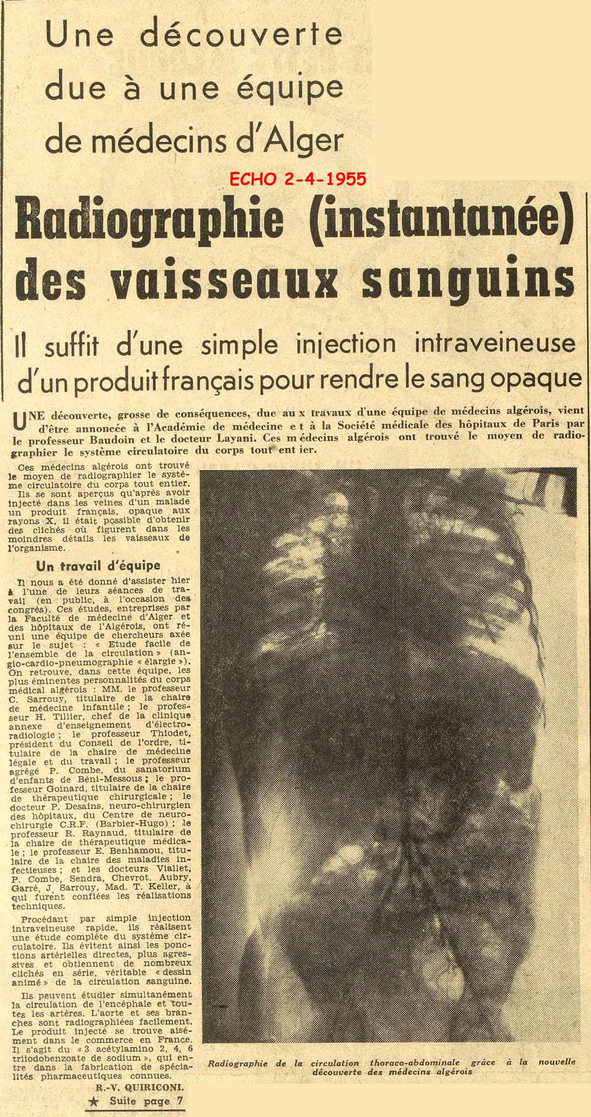 Radiographie (instantan&eacute;e) des vaisseaux sanguins 