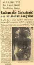 Radiographie (instantan&eacute;e) des vaisseaux sanguins 